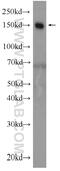 Complement Factor H antibody, 12748-1-AP, Proteintech Group, Western Blot image 