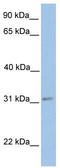 Enoyl-CoA Hydratase Domain Containing 2 antibody, TA346864, Origene, Western Blot image 