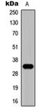 Zinc Finger Protein 75D antibody, orb315749, Biorbyt, Western Blot image 