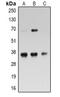 Ribosomal Protein L5 antibody, LS-C368692, Lifespan Biosciences, Western Blot image 