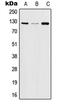 Janus Kinase 2 antibody, MBS822241, MyBioSource, Western Blot image 