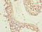 Centrosomal Protein 72 antibody, orb41038, Biorbyt, Immunohistochemistry paraffin image 