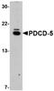 Programmed cell death protein 5 antibody, orb89461, Biorbyt, Western Blot image 