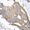 Stromelysin-3 antibody, LS-C332335, Lifespan Biosciences, Immunohistochemistry paraffin image 
