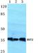 Bone Marrow Stromal Cell Antigen 2 antibody, A00934-1, Boster Biological Technology, Western Blot image 