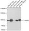EMSY Transcriptional Repressor, BRCA2 Interacting antibody, A6138, ABclonal Technology, Western Blot image 