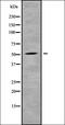 Solute Carrier Family 2 Member 2 antibody, orb338739, Biorbyt, Western Blot image 