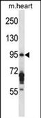 Exocyst Complex Component 6B antibody, PA5-71838, Invitrogen Antibodies, Western Blot image 