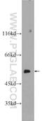 Chaperonin Containing TCP1 Subunit 2 antibody, 24896-1-AP, Proteintech Group, Western Blot image 