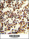 CD19 antibody, A00154, Boster Biological Technology, Immunohistochemistry paraffin image 