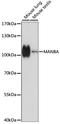 Mannosidase Beta antibody, A15289, ABclonal Technology, Western Blot image 