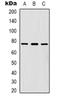 Forkhead Box K1 antibody, orb318939, Biorbyt, Western Blot image 