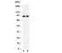 Minichromosome Maintenance Complex Component 3 antibody, R30735, NSJ Bioreagents, Western Blot image 