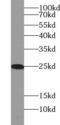 Ribosomal Protein L29 antibody, FNab09831, FineTest, Western Blot image 