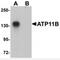 Probable phospholipid-transporting ATPase IF antibody, MBS150922, MyBioSource, Western Blot image 