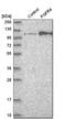 Fibroblast Growth Factor Receptor 4 antibody, HPA027273, Atlas Antibodies, Western Blot image 