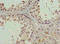 Histone Cluster 2 H2A Family Member C antibody, orb24553, Biorbyt, Immunohistochemistry paraffin image 
