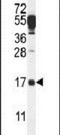 D-Aminoacyl-TRNA Deacylase 2 antibody, PA5-24053, Invitrogen Antibodies, Western Blot image 