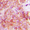 CRK Proto-Oncogene, Adaptor Protein antibody, LS-C353943, Lifespan Biosciences, Immunohistochemistry paraffin image 