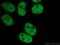 Cell cycle and apoptosis regulator protein 2 antibody, 66497-1-Ig, Proteintech Group, Immunofluorescence image 