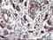 ChaC Glutathione Specific Gamma-Glutamylcyclotransferase 1 antibody, LS-C788429, Lifespan Biosciences, Immunohistochemistry paraffin image 