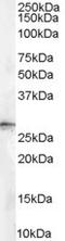 14-3-3 sigma antibody, EB07061, Everest Biotech, Western Blot image 