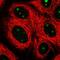 Spermatogenesis Associated 17 antibody, HPA030099, Atlas Antibodies, Immunocytochemistry image 