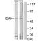 Triokinase And FMN Cyclase antibody, A12154, Boster Biological Technology, Western Blot image 