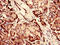 Chitinase Domain Containing 1 antibody, CSB-PA883614LA01HU, Cusabio, Immunohistochemistry frozen image 