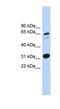 Family With Sequence Similarity 234 Member A antibody, NBP1-59854, Novus Biologicals, Western Blot image 