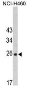 FKBP Prolyl Isomerase 14 antibody, AP17379PU-N, Origene, Western Blot image 
