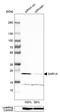 Secretion Associated Ras Related GTPase 1A antibody, HPA006923, Atlas Antibodies, Western Blot image 