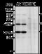 Leucine-rich repeat and death domain-containing protein antibody, ALX-804-889-C100, Enzo Life Sciences, Western Blot image 