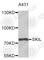 SKI Like Proto-Oncogene antibody, A5844, ABclonal Technology, Western Blot image 