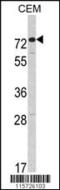 Anti-Mullerian Hormone Receptor Type 2 antibody, 62-668, ProSci, Western Blot image 