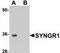 Synaptogyrin-1 antibody, TA306904, Origene, Western Blot image 