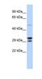RNA Transcription, Translation And Transport Factor antibody, orb324786, Biorbyt, Western Blot image 