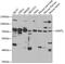 Acetylserotonin O-Methyltransferase Like antibody, GTX33021, GeneTex, Western Blot image 