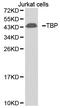 TATA-Box Binding Protein antibody, LS-C331971, Lifespan Biosciences, Western Blot image 