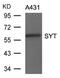 SS18 Subunit Of BAF Chromatin Remodeling Complex antibody, PA5-49678, Invitrogen Antibodies, Western Blot image 