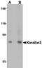 Fermitin Family Member 3 antibody, A05406, Boster Biological Technology, Western Blot image 