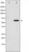 LIM Domain Kinase 1 antibody, TA325618, Origene, Western Blot image 