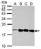 Neurocalcin Delta antibody, GTX121264, GeneTex, Western Blot image 