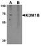 Lysine-specific histone demethylase 1B antibody, LS-B10141, Lifespan Biosciences, Western Blot image 