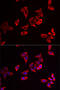 Ribosomal Protein L9 antibody, 22-196, ProSci, Immunofluorescence image 