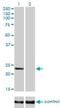 RAB9A, Member RAS Oncogene Family antibody, H00009367-M01, Novus Biologicals, Western Blot image 