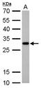 SCP 2 antibody, LS-C185670, Lifespan Biosciences, Western Blot image 