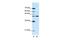 Neuromedin U Receptor 2 antibody, GTX47665, GeneTex, Western Blot image 