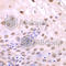 Sequestosome 1 antibody, A7758, ABclonal Technology, Immunohistochemistry paraffin image 