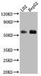 Monoamine Oxidase B antibody, CSB-RA999377A0HU, Cusabio, Western Blot image 